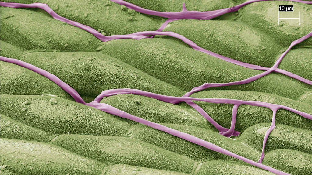 Hyphae entering stomata on untreated leaf surface