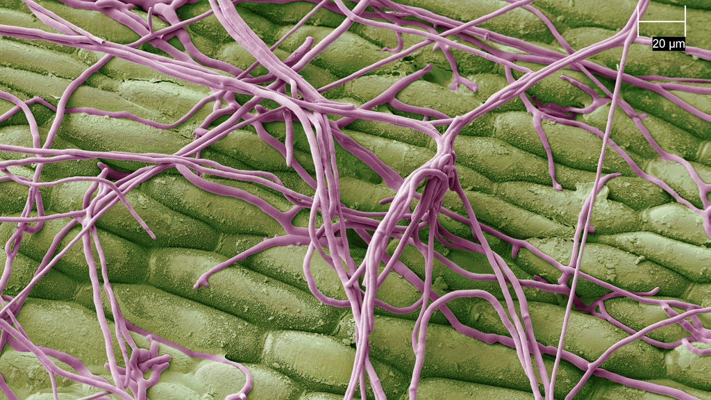 Disease hyphae on turf surface seeking entry points through stomata or leaf damage and gaps in contact fungicide coverage